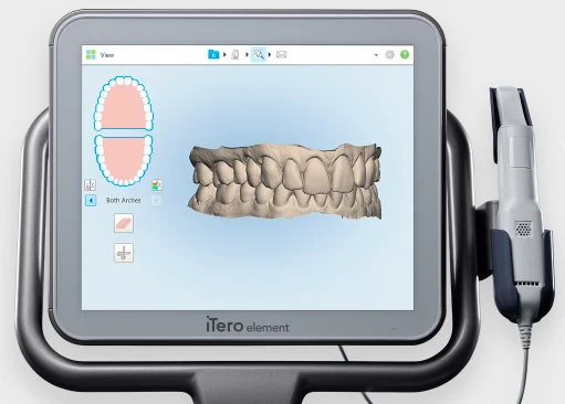 Invisalign in Bangalore | Invisible braces | Little pearls dental | Orthodontists