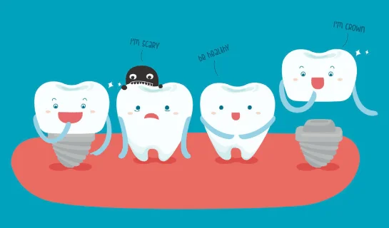 Dental implant procedure | the truth about dental implants