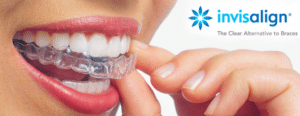 Little Pearls Orthodontics - Experienced Orthodontists for Braces & Clear aligners.