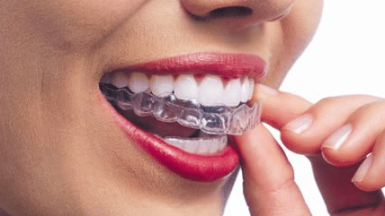 About little pearls invisalign bangalore