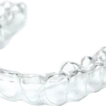 Invisalign center Bangalore