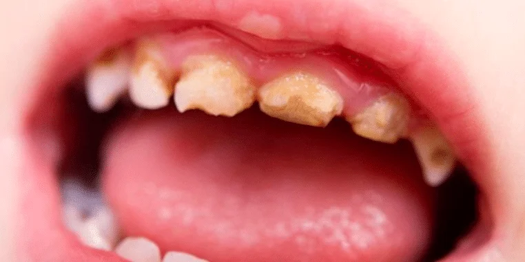 Media Library ‹ Little Pearls Dental Care — WordPress