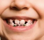 Our team of skilled pediatric dentists offering personalized care for young patients. Little Pearls Dental Care creates a fun and stress-free experience for children.