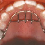 State-of-the-art dental equipment used for safe and effective pediatric treatments. Little Pearls Dental Care prioritizes your child's comfort and health