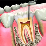 State-of-the-art dental equipment used for safe and effective pediatric treatments. Little Pearls Dental Care prioritizes your child's comfort and health