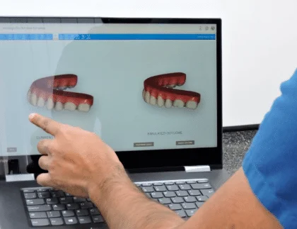 A few tips you can use to save on the overall cost of Invisalign in Bangalore