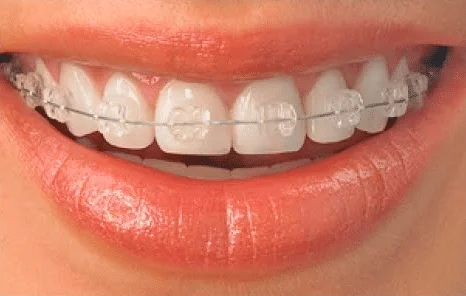 At Little Pearls Dental Care, we specialize in providing compassionate and expert pediatric dental services, ensuring every child’s smile shines bright. Our experienced team is dedicated to creating a welcoming and stress-free environment, making dental visits enjoyable for kids and parents alike. Trust us to care for your child’s oral health with the latest technology and a gentle touch.
