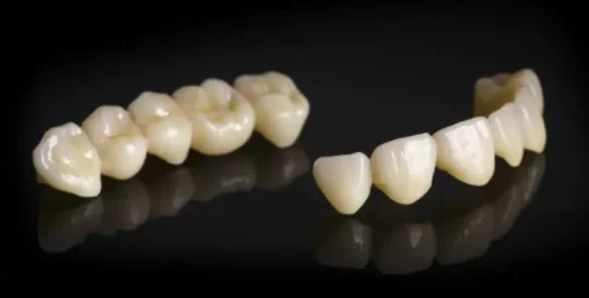 Disadvantages of Zirconia Dental Crowns