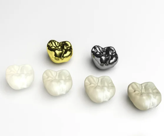What Is A Dental Crown