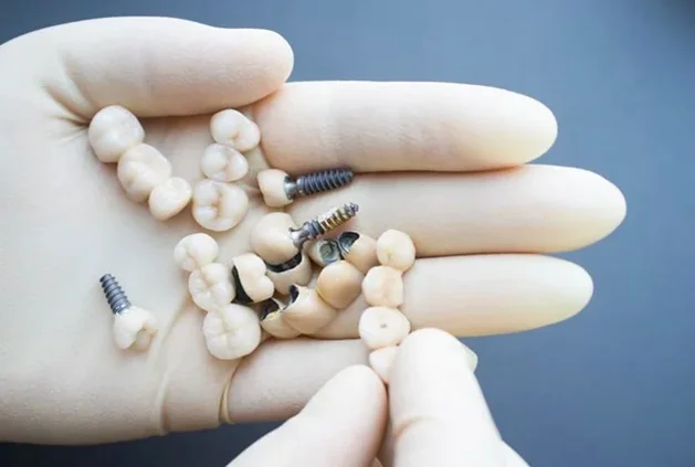 Disadvantages of porcelain dental crowns