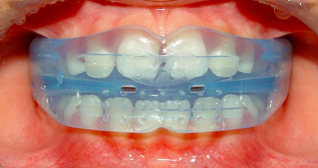 Oral Screen