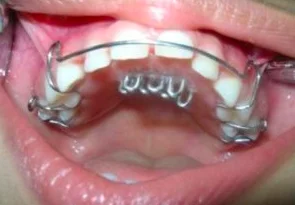 Spiky Tongue Crib